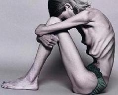 Anorexia