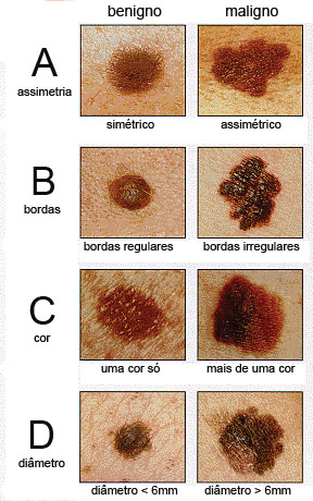 ABCD dos sinais